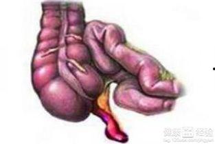 阑尾疼可以吃瓜吗,西瓜，甜蜜的禁忌？